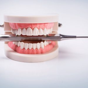 white-teeth (1)